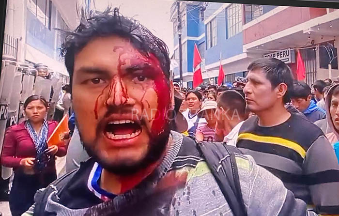 Citan a obrero de construcción civil golpeado por policía para que rinda su manifestación 